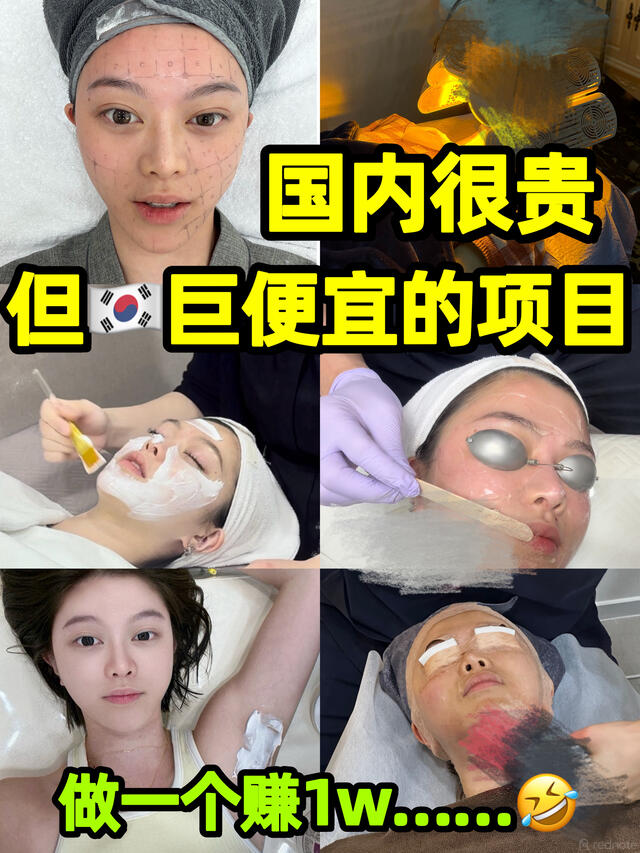 한국 피부과 시술 체험 기록
